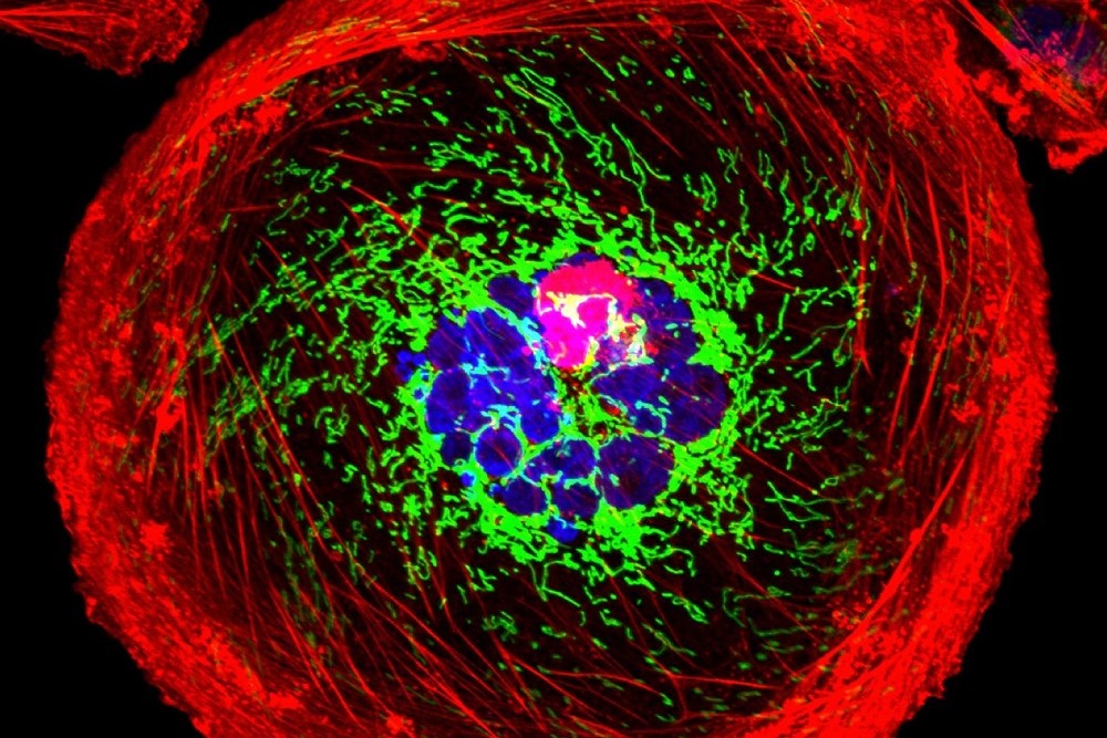 Pheast Therapeutics Raises $76 Million in Series A Financing; Plans to Give Cancer Immunotherapies a New Angle